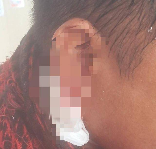 黄岩岛交锋，中方这次没客气：菲船员耳朵被崩伤，高举白旗求饶