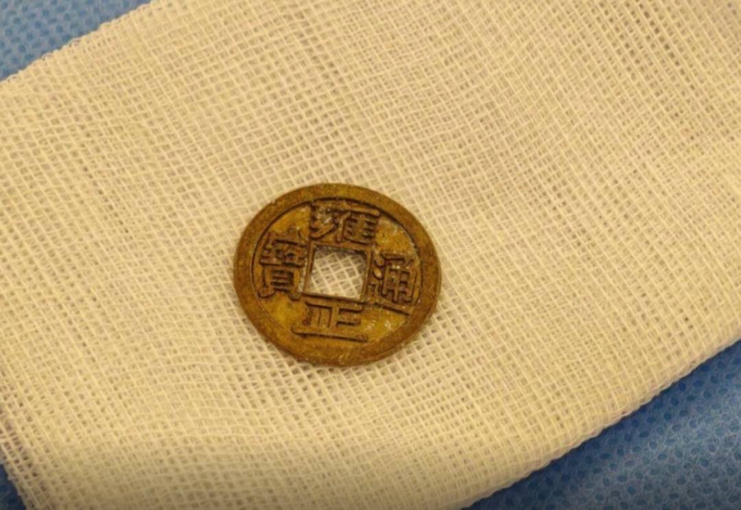 祈福币险变“夺命符” !医生紧急提醒